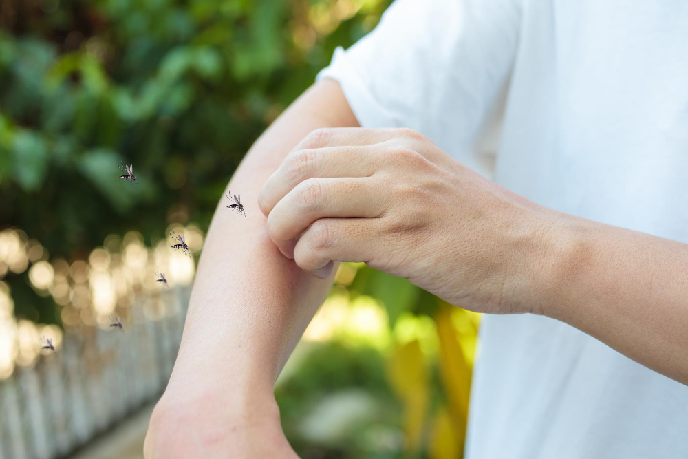 Cómo evitar picaduras de mosquitos en casa durante el mes más caluroso